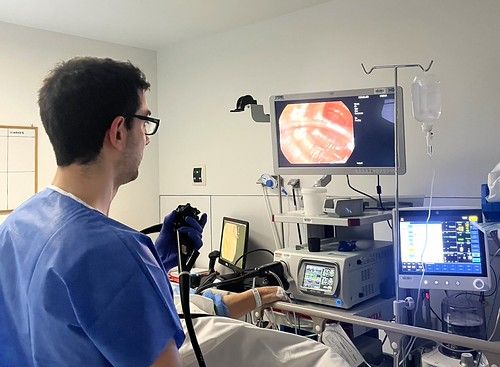 La endoscopia avanzada transforma el tratamiento del cáncer de colon en fases iniciales La endoscopia avanzada transforma el tratamiento del cáncer de colon en fases iniciales